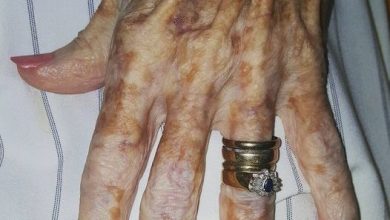 Photo of Nurse takes photo of old lady’s hand – then sees detail in the picture that has the internet exploding