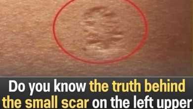 Photo of The Hidden Meaning of the Tiny Scar on Your Upper Left Arm