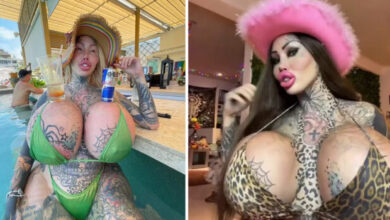 Photo of Tragic update on surgery-addicted woman who wanted to become a”forest elf”